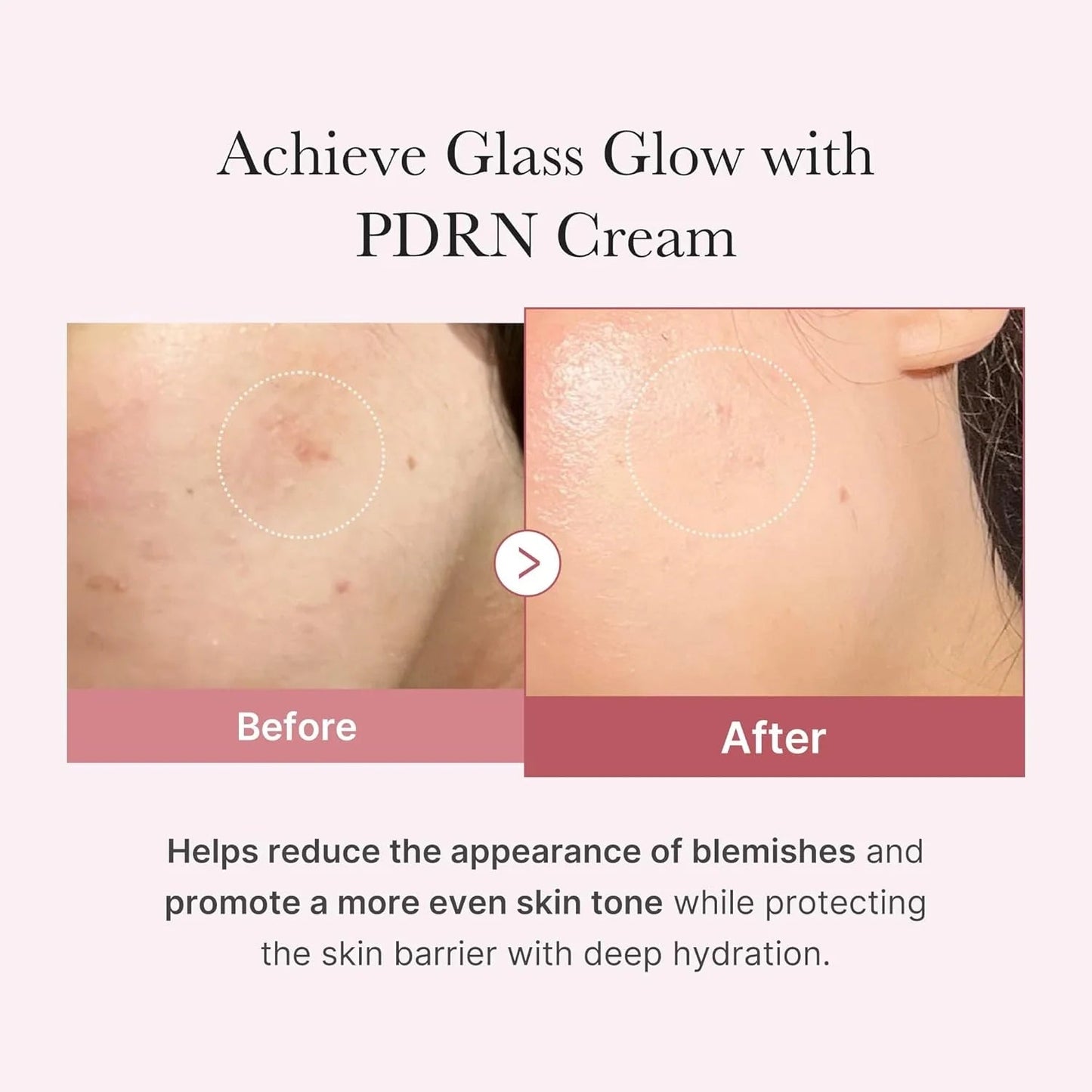 Medicube – Pore Pink Cica Kit | Poros + Calmante + Hidratación