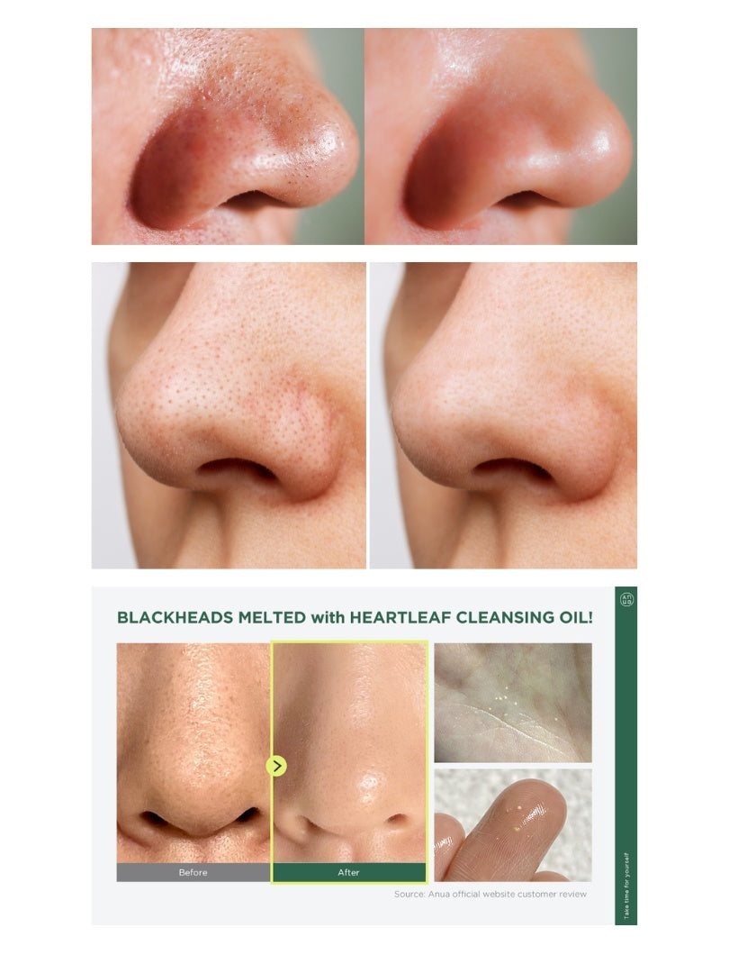 Heartleaf Pore Control Cleansing Oil