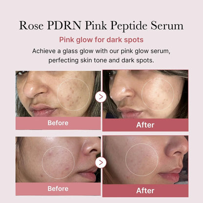 Medicube – PDRN Pink Glutathione Serum Mist | Bruma Iluminadora & Reparadora · Antioxidante 100ml